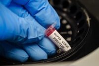 1769511902512-virus-nipah-1769414647781_43