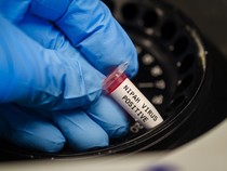 1769511902512-virus-nipah-1769414647781_43